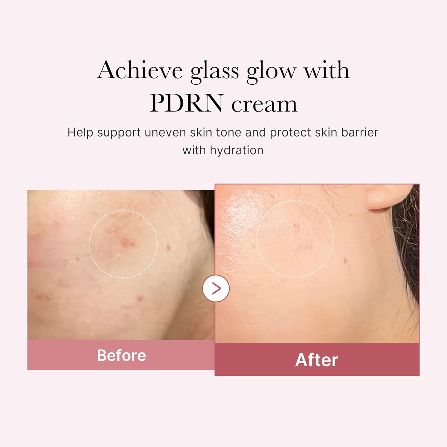 https://buraki.pk/products/medicube-pdrn-pink-hyaluronic-moisturizing-cream
