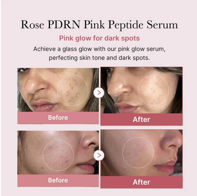 https://buraki.pk/products/medicube-pdrn-pink-peptide-serum