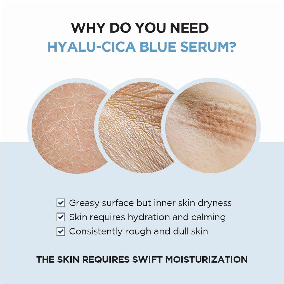 https://buraki.pk/products/skin1004-hyalu-cica-blue-serum-multi-care-solutions