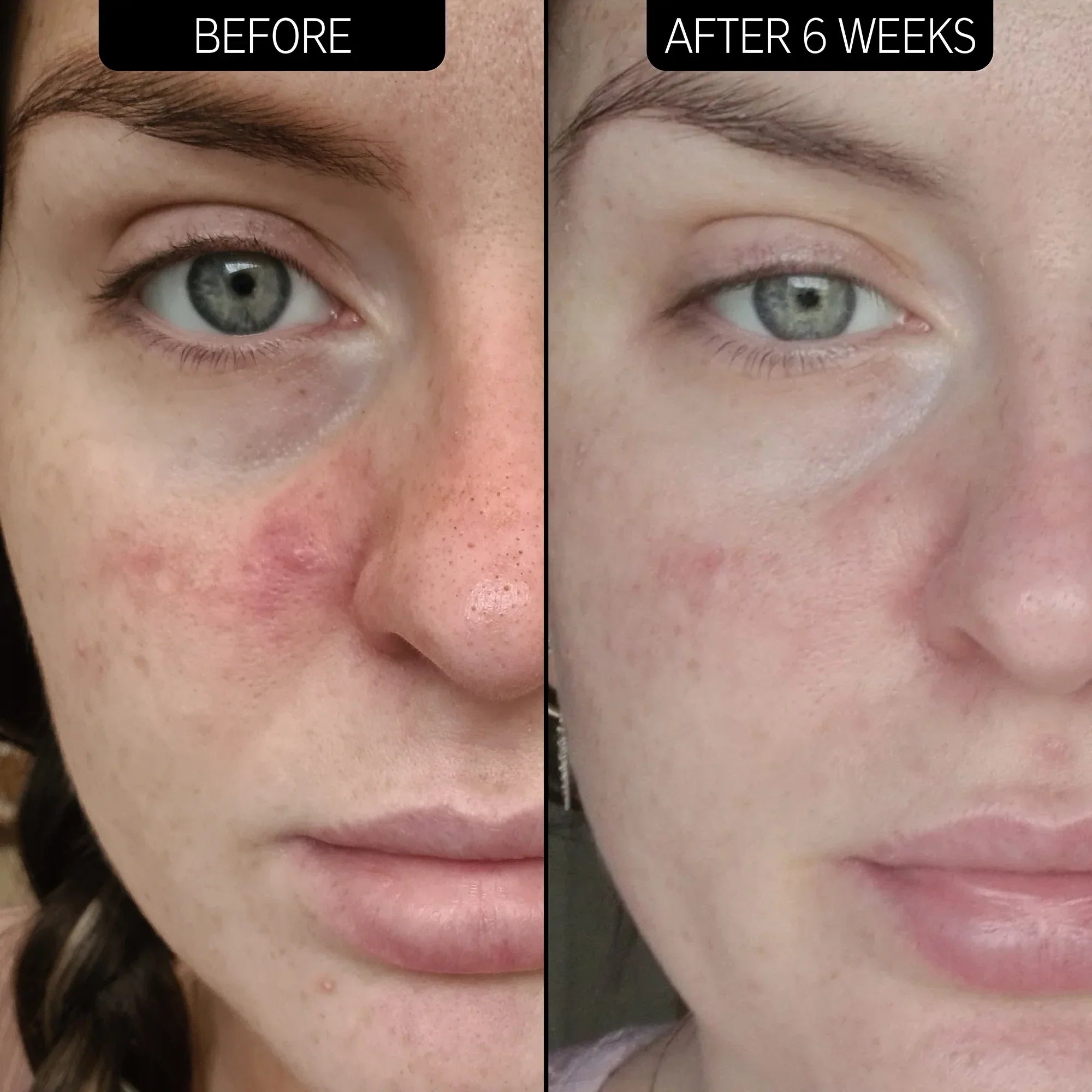 https://buraki.pk/products/the-inkey-list-redness-relief-10-azelaic-acid-serum
