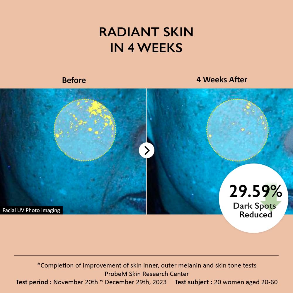 https://buraki.pk/products/haruharu-wonder-centella-4-txa-dark-spot-go-away-serum