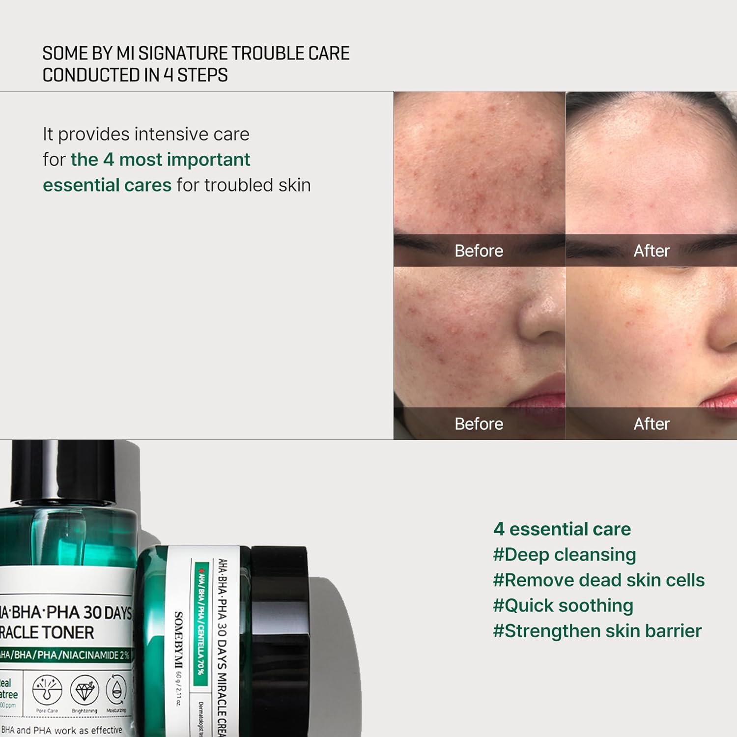 https://buraki.pk/products/some-by-mi-aha-bha-pha-30-days-miracle-starter-kit