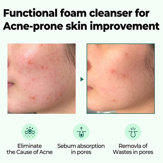 https://buraki.pk/products/some-by-mi-aha-bha-pha-30-days-miracle-acne-clear-foam