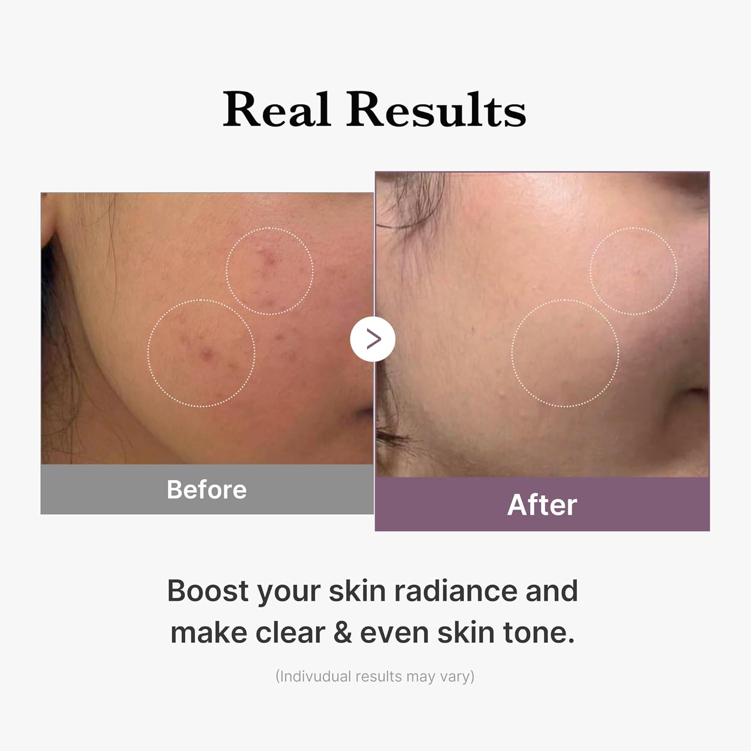 https://buraki.pk/products/medicube-age-r-glutathione-glow-toner