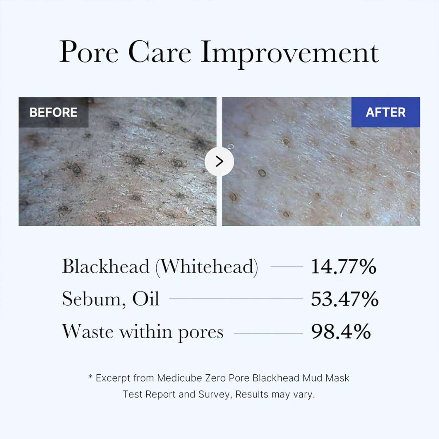 https://buraki.pk/products/medicube-zero-pore-blackhead-mud-mask