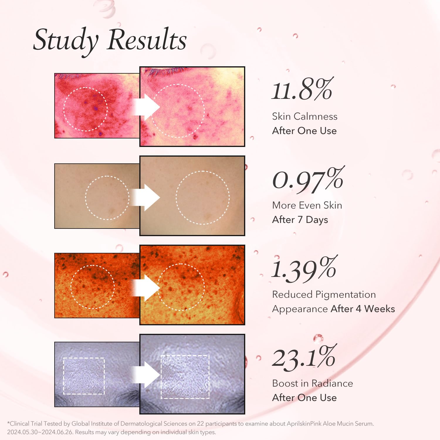 https://buraki.pk/products/aprilskin-pink-aloe-mucin-serum
