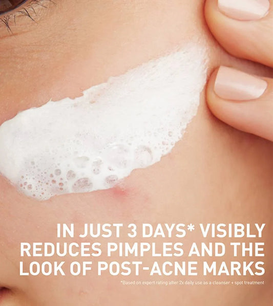 https://buraki.pk/products/cerave-acne-clay-to-foam-cleanser