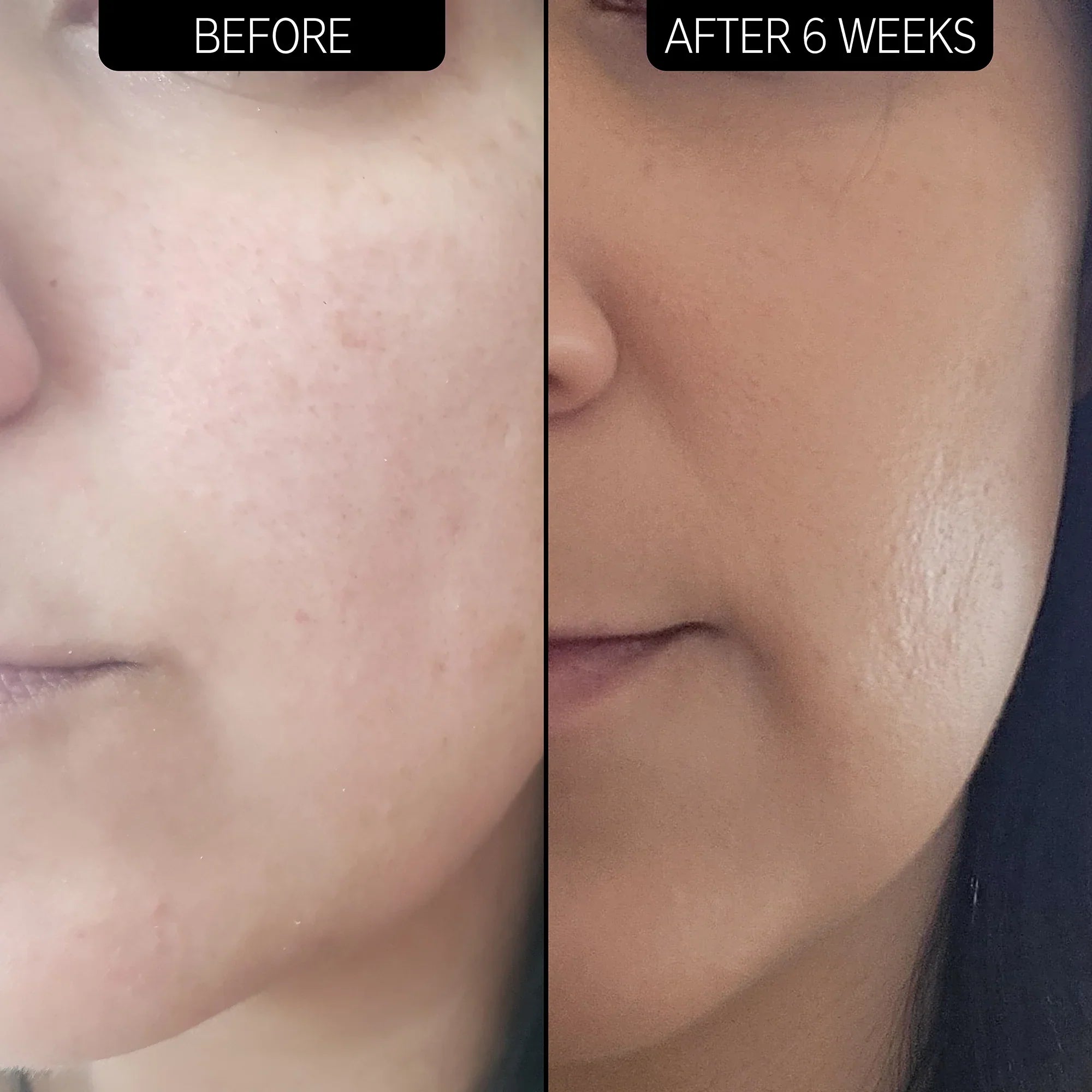https://buraki.pk/products/the-inkey-list-dry-and-rough-skin-solution-with-10-urea-moisturizer