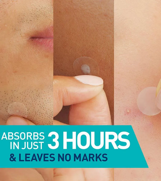 https://buraki.pk/products/cerave-blemish-barrier-patches