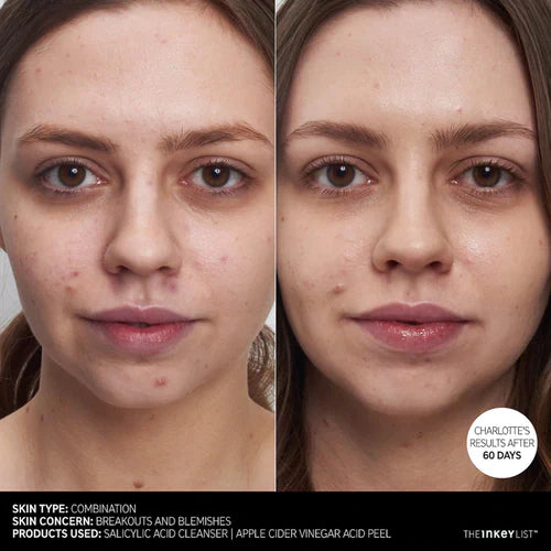 https://buraki.pk/products/the-inkey-list-salicylic-acid-cleanser-without-box