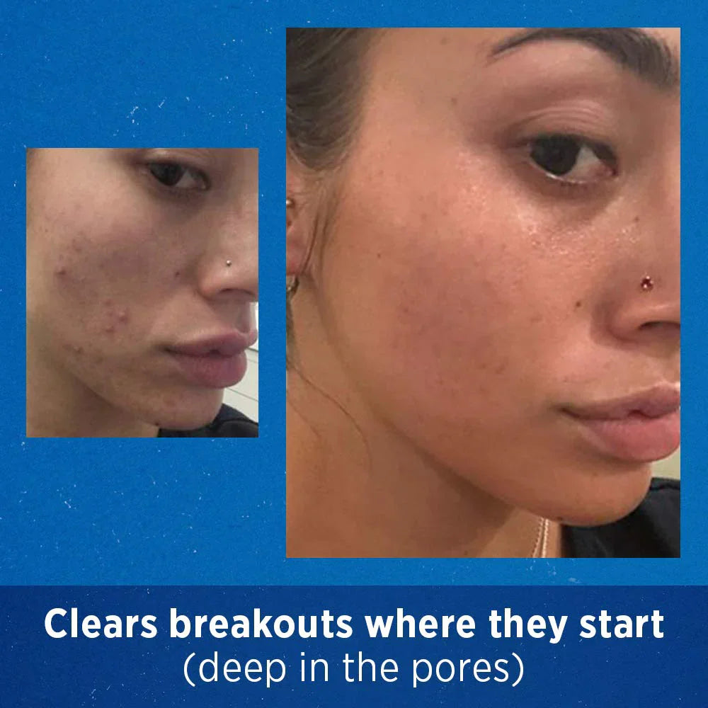 https://buraki.pk/products/differin-gel