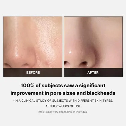 https://buraki.pk/products/medicube-zero-pore-toner-pads