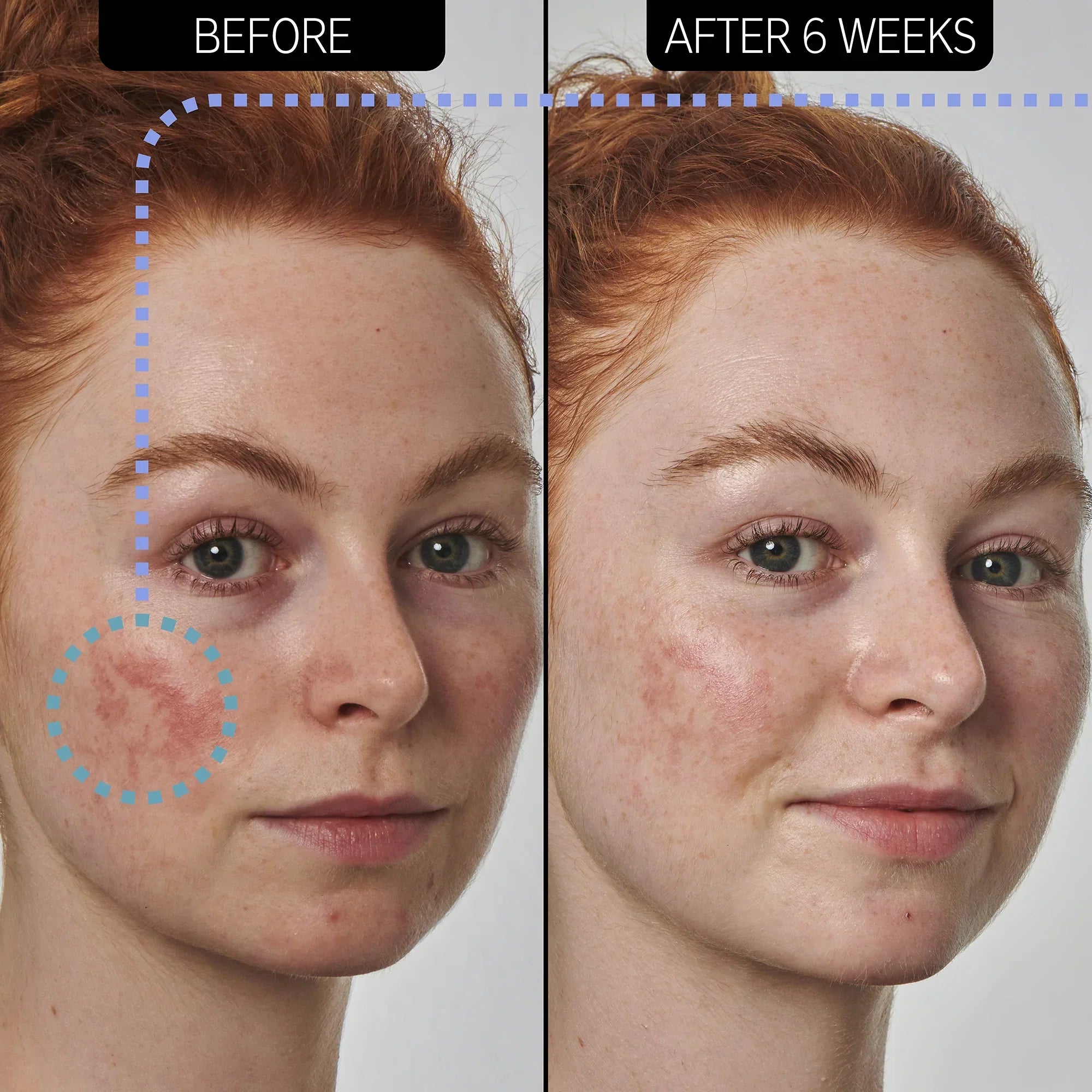 https://buraki.pk/products/the-inkey-list-redness-relief-10-azelaic-acid-serum