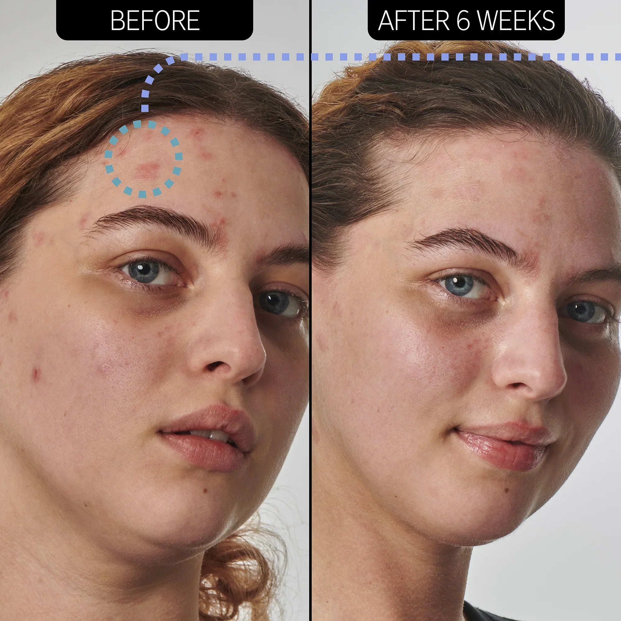 https://buraki.pk/products/the-inkey-list-dry-and-rough-skin-solution-with-10-urea-moisturizer