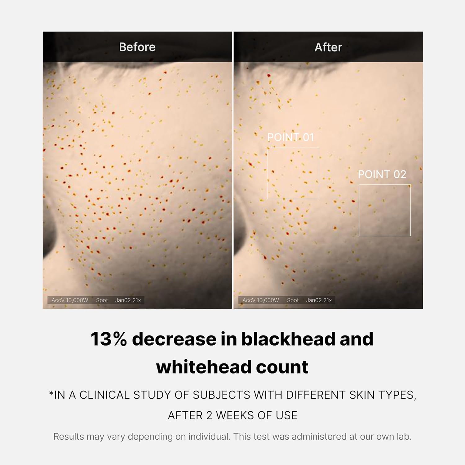 https://buraki.pk/products/medicube-zero-pore-one-day-serum