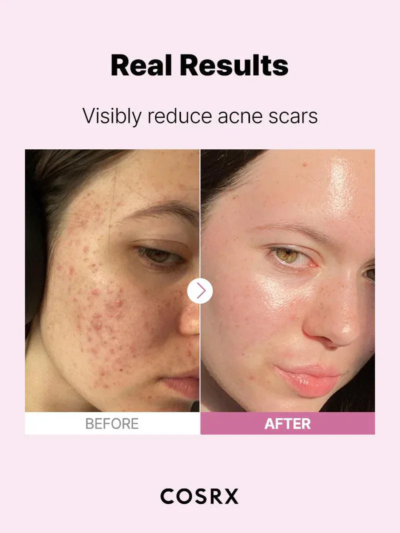 https://buraki.pk/products/cosrx-the-niacinamide-15-serum